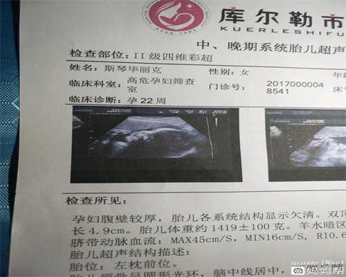 重庆弱精做试管的成功率高吗,重庆国内权威助孕服务,重庆助孕哪家好