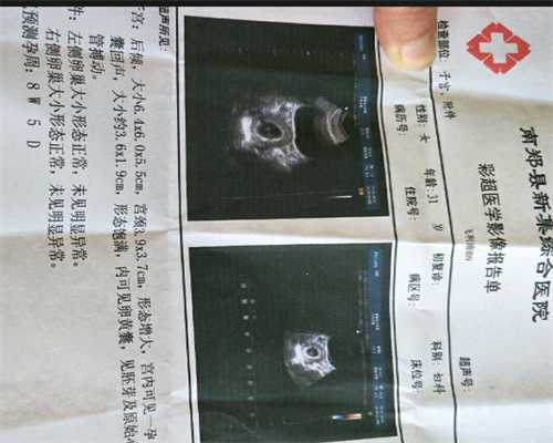 重庆借腹生子代怀中心,重庆代生妈妈哪里找,孕前染色体检查要检查那些项目？