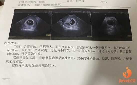 重庆地下供卵试管,2022年最新重庆供卵试管婴儿医院排名？