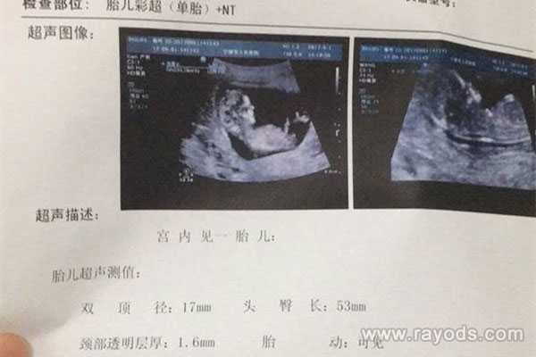 重庆代生子价格~重庆专业供卵机构电话，孕期穿不对内衣，不止胸部下垂，当