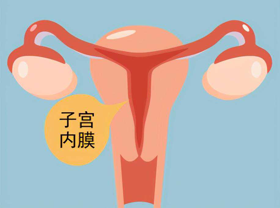 子宫内膜过厚会影响女性生育力