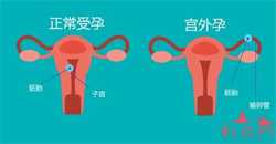 重庆知名助孕集团，重庆助孕多少钱？附流程表！